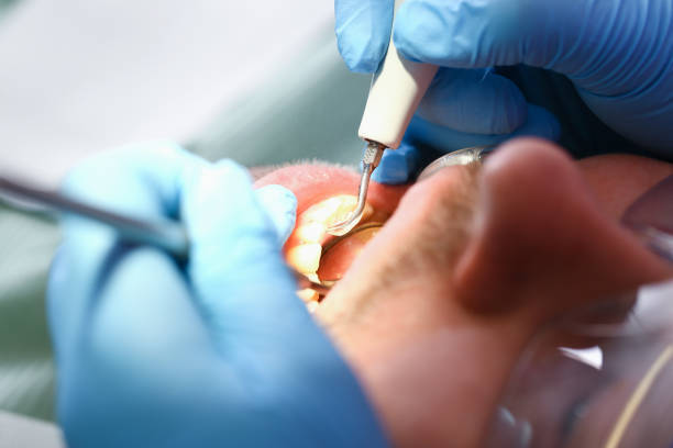 Best Emergency Tooth Extraction  in North Branch, MI