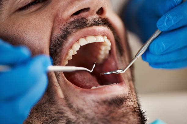 Best Emergency Gum Pain Relief  in North Branch, MI